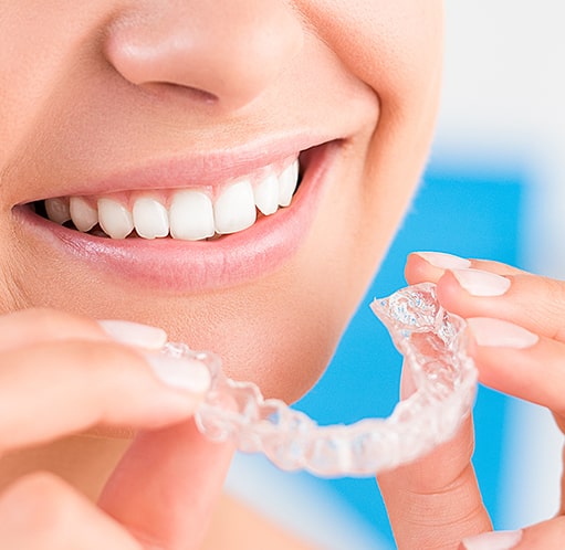 invisalign braces